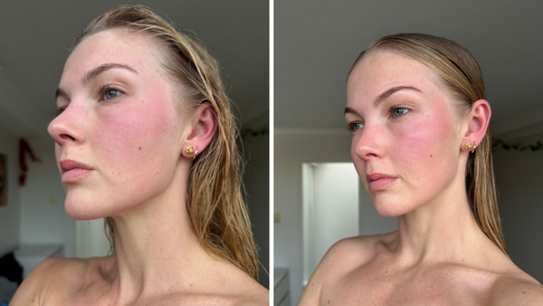 From Winter-Dry to Spring-Dewy in 7 Days: EAORON's Hydration Reset